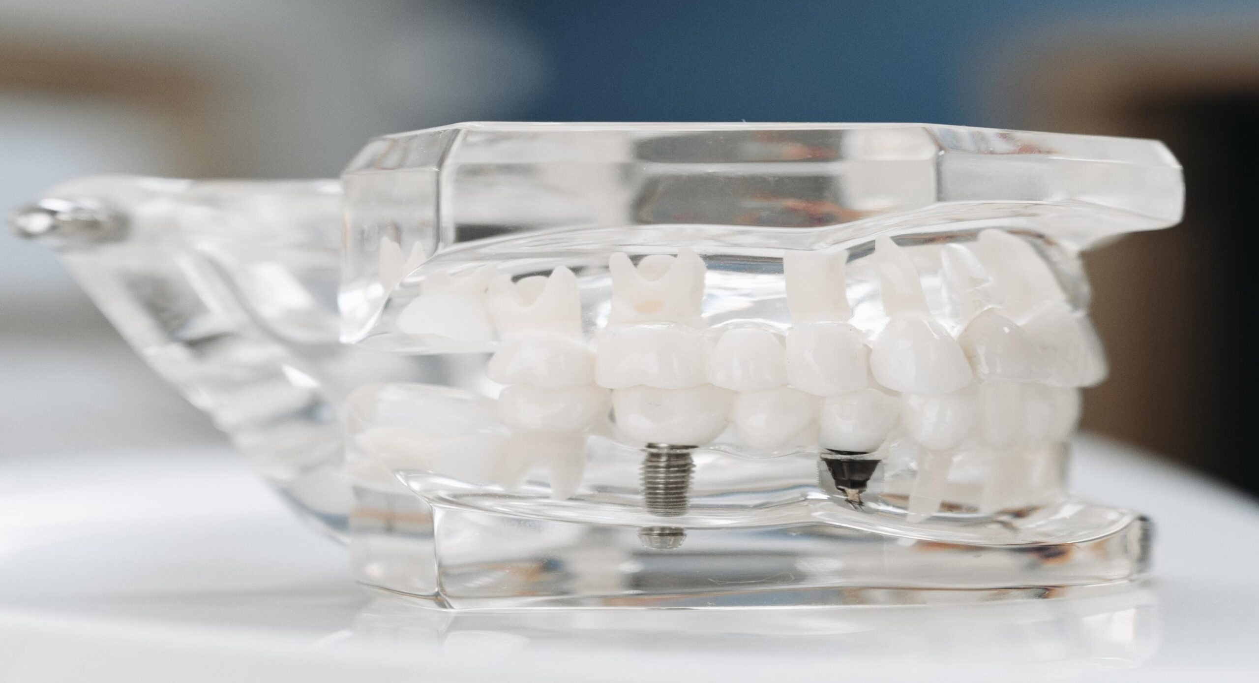 clear Aligners Lake Forest